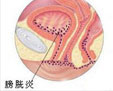 合肥治疗男性炎症哪家好